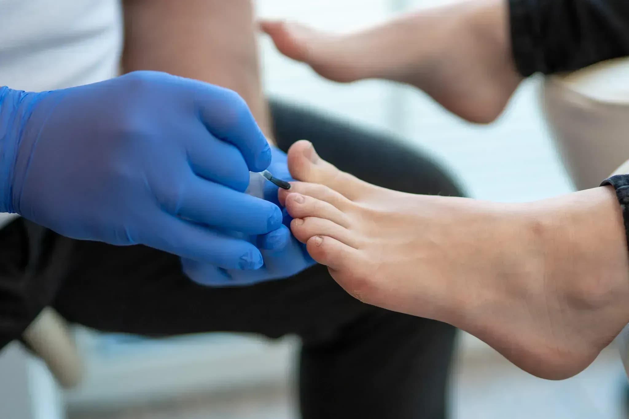 Erstklassige Fußpflege bei Nagelproblemen in Linz